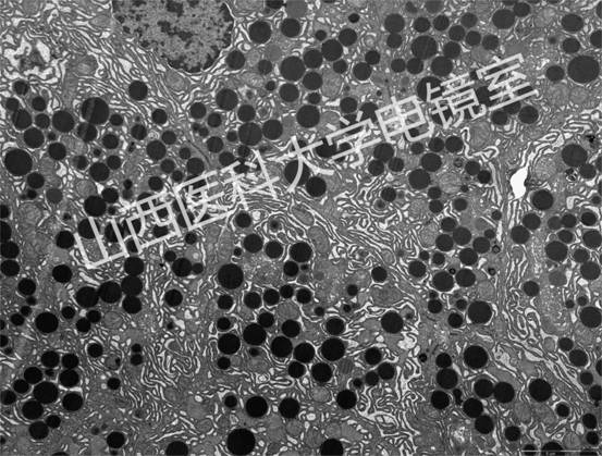 胰腺內分泌細胞